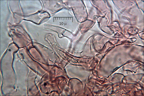 Clavulina-cinerea_4M