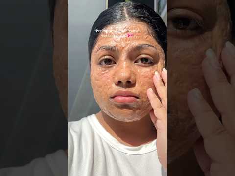 Bored with my old skin🤍 #beautytips #beautyideas #glassskin #skincaretips #viralshots